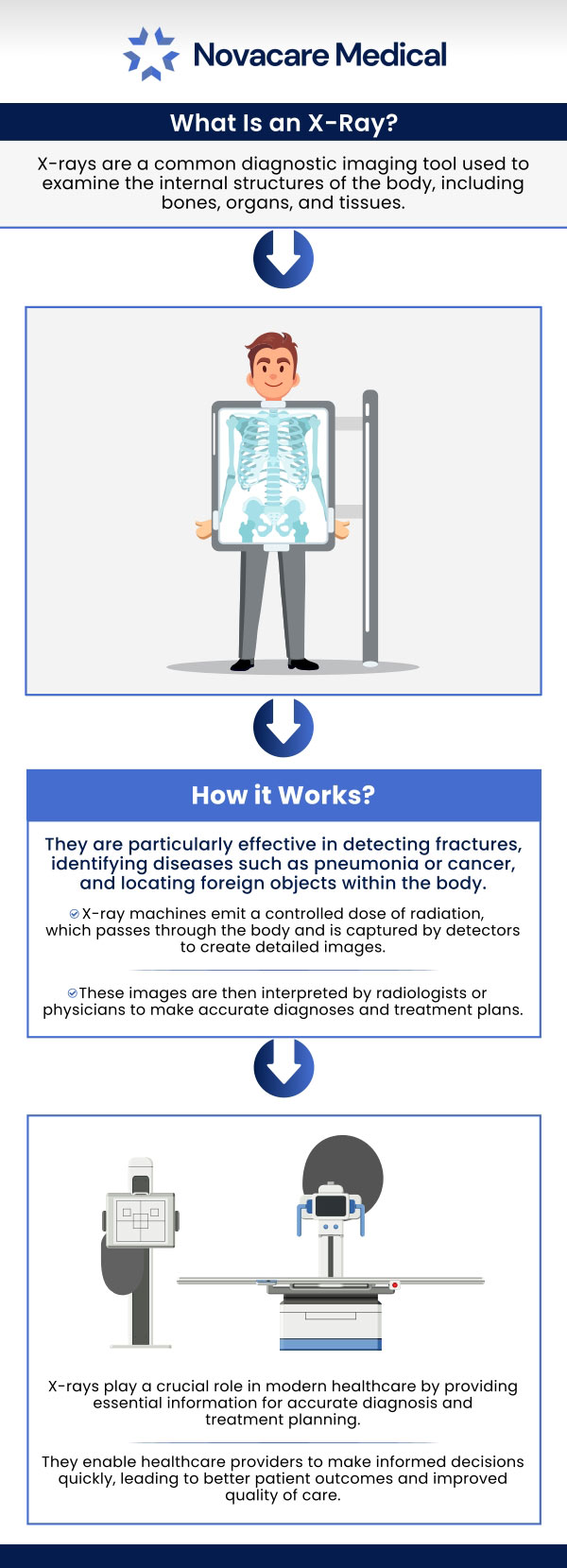 An X-ray is a painless treatment that is used to diagnose numerous medical disorders. It is frequently employed to create an image of the body's interior. Mostly this procedure is used to examine joints and bones but sometimes it can also be used to analyze soft tissues such as internal organs. Our skilled team of medical professionals at Nova Medical Group provides X-ray services to identify many conditions, such as tumors, some traumas, calcification, foreign objects, and shattered bone fractures. To learn more about the benefits of X-rays services, contact us today or book an appointment online. We are located over at 401 N Bedford St, East Bridgewater, MA 02333.